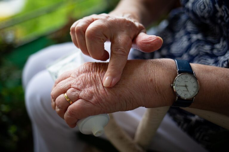 Astuces pour traiter l’arthrite sans médicaments
